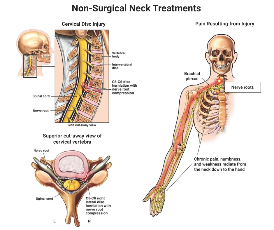 Neck Pain Treatment NYC